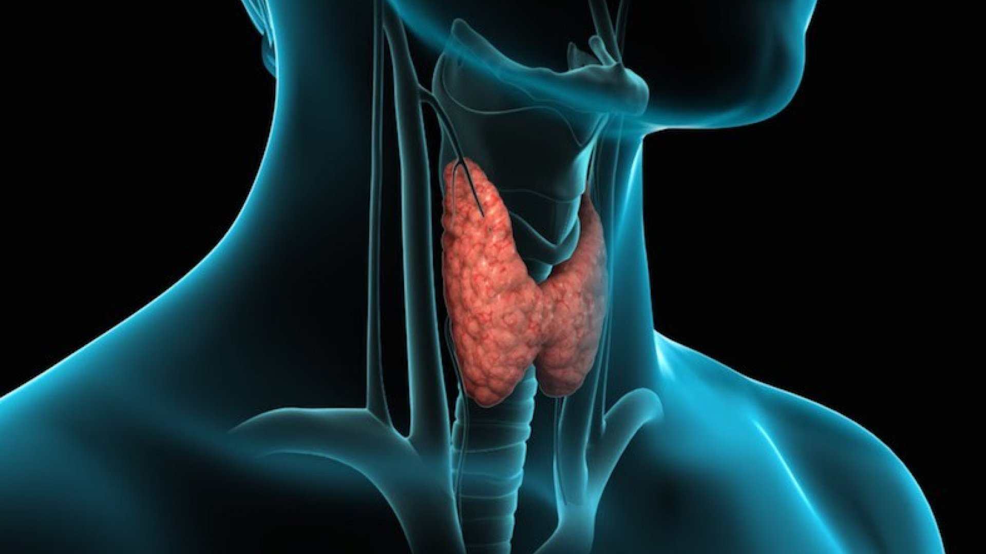 Tiroid 1 ankara tiroid tedavisi dr emre apaydın