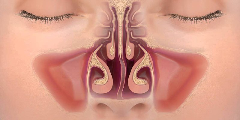 Ankara Burun Kemik Eğriliği Ameliyatı