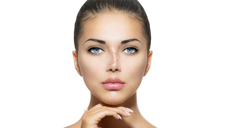 Burun Kemik Eğriliği